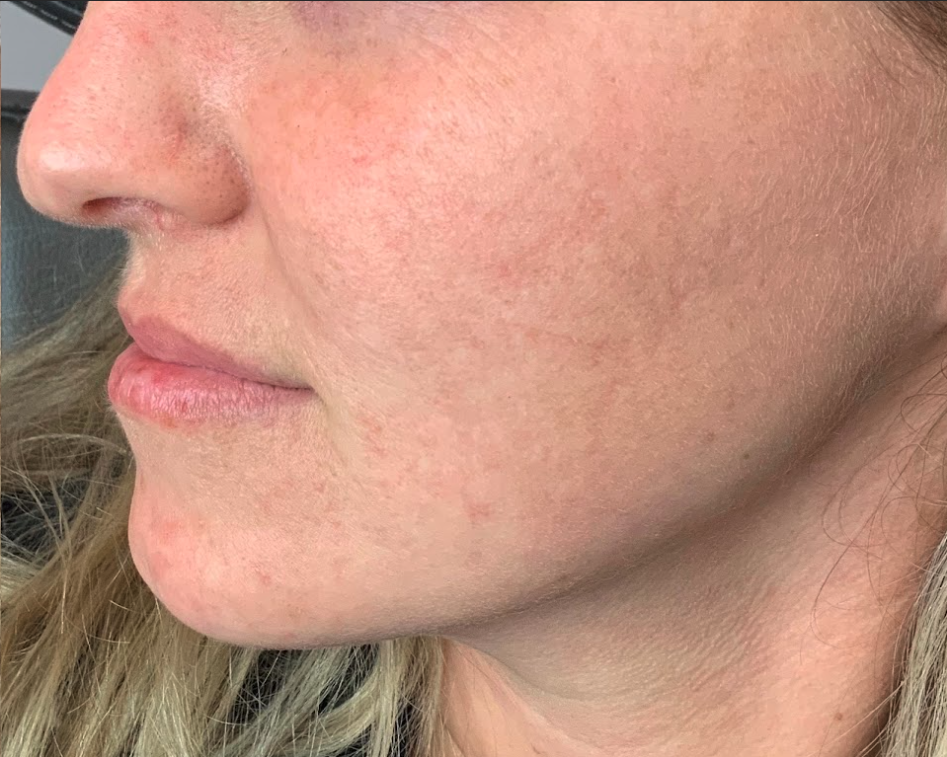 Captura de pantalla 2025-01-08 a las 13.53.45