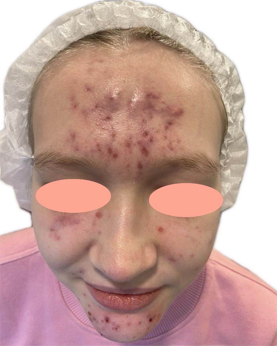 IMG_3585 2 en tamaño grande