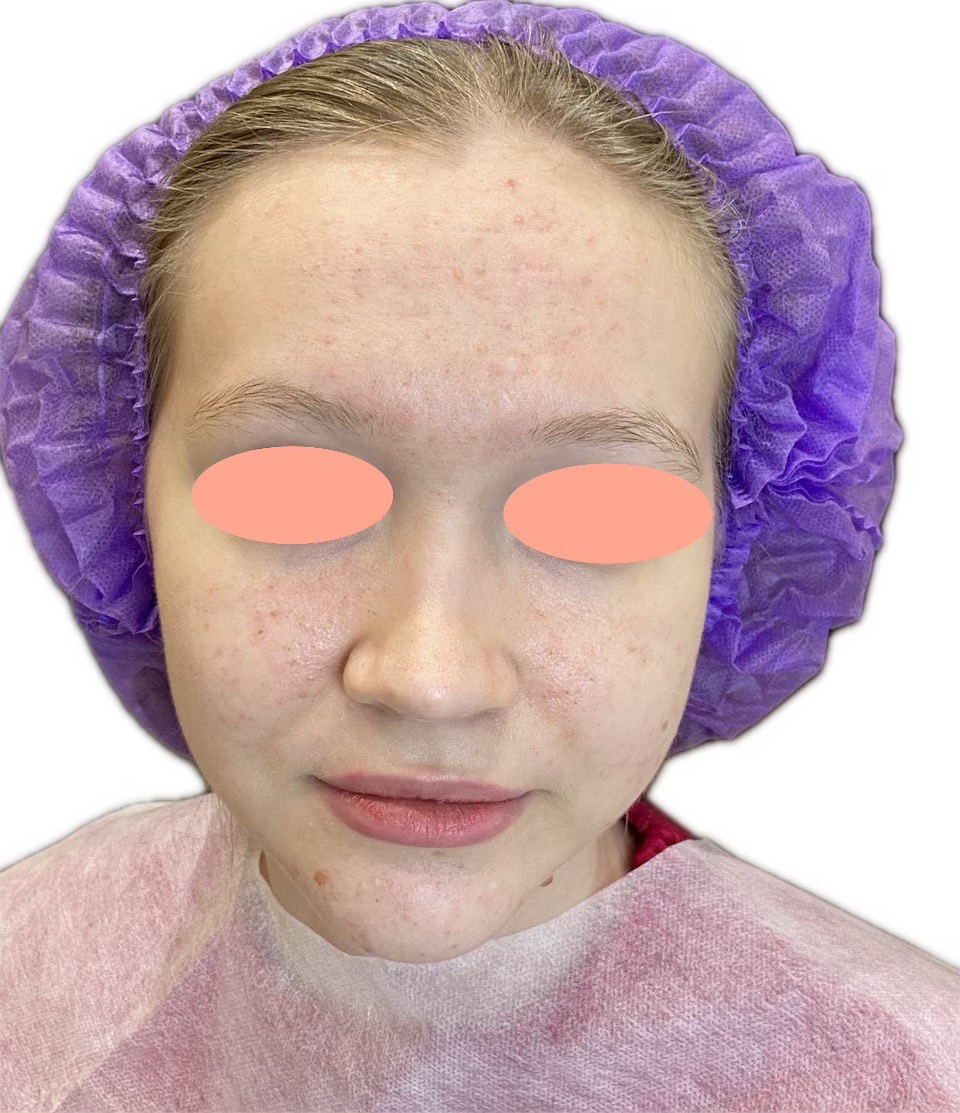 IMG_3586 2 en tamaño grande